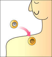 体に貼ることもできます